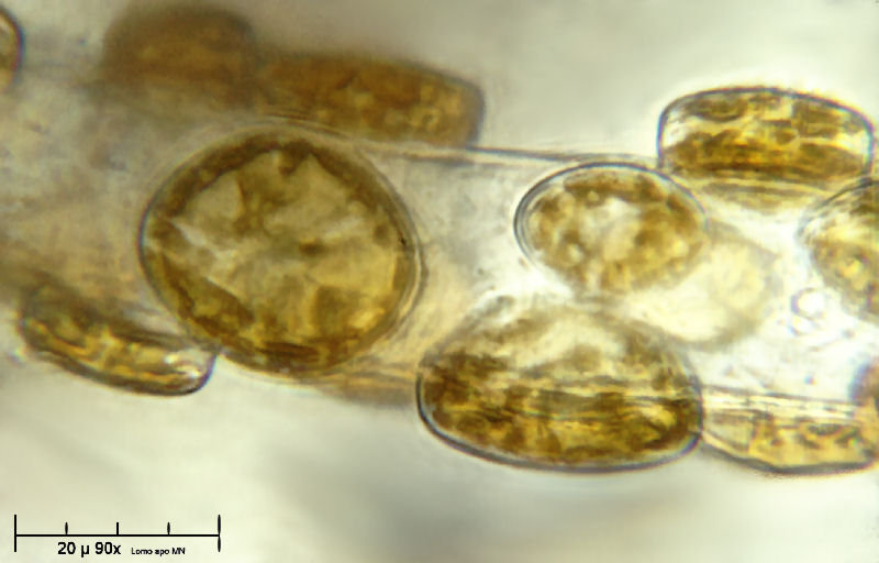 Cocconeis sp.