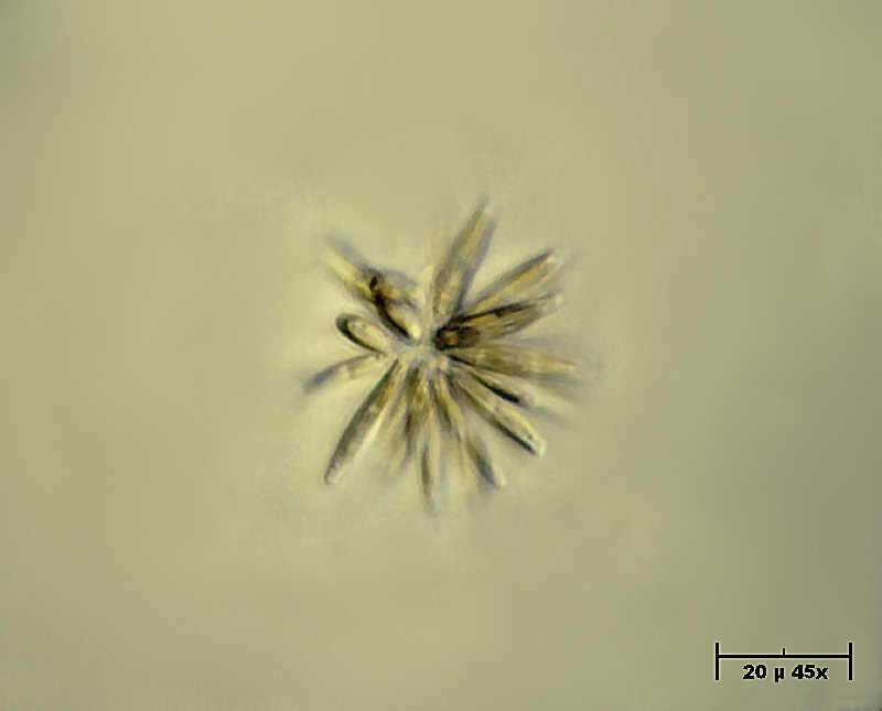 Synedra sp.