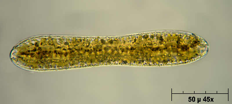 Cymatopleura solea
