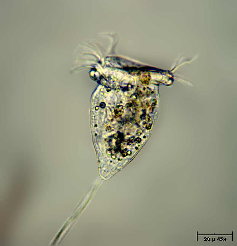 Vorticella sp.
