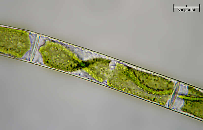 Alga caramella - Mougeotia sp.