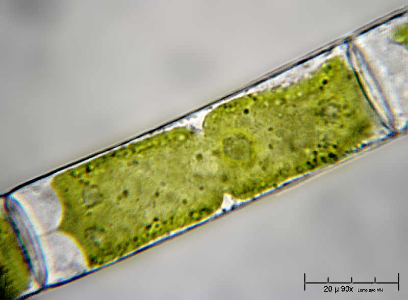 Alga caramella - Mougeotia sp.