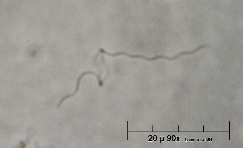 roba da Esco - (Spirillum sp.)
