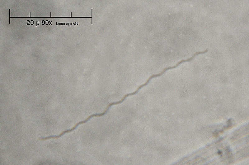 roba da Esco - (Spirillum sp.)