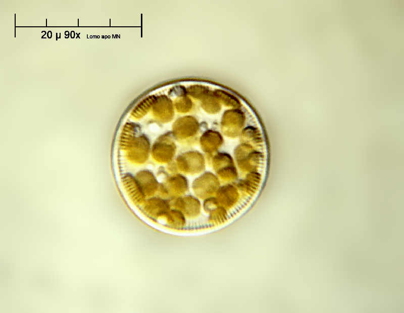 Cyclotella sp.