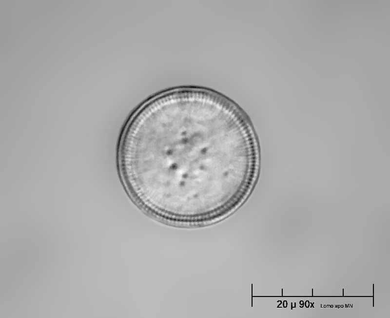 frustolo di Cyclotella sp.