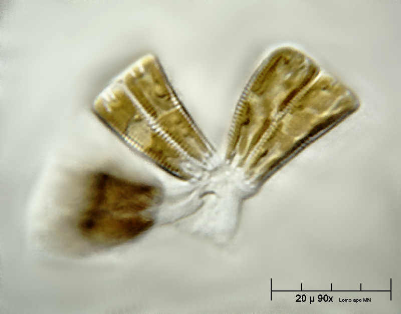 Gomphonema sp. ??