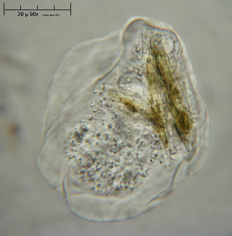 ameba - Vanella sp. ???