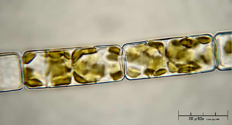 altra Melosira varians, 90x immersione acqua