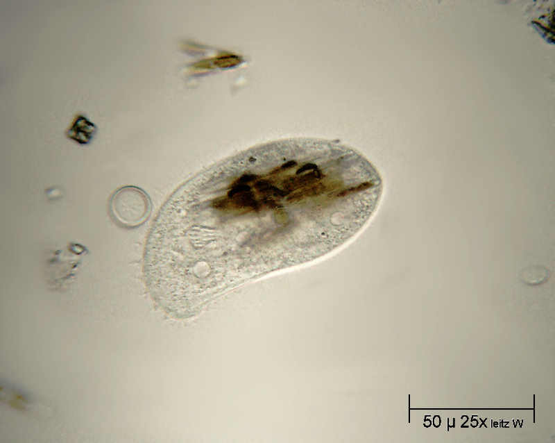 divoratore di navicule - Chilodonella sp. ?