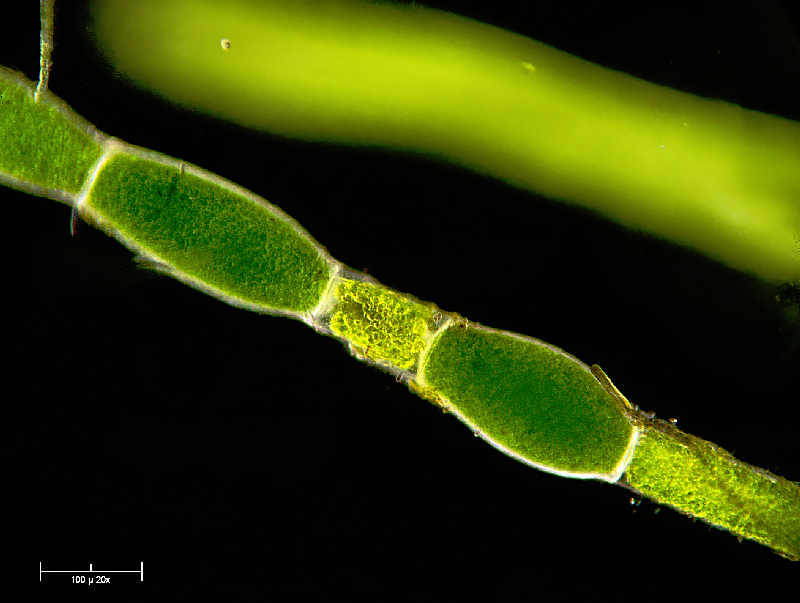 Cladophora sp. in campo oscuro