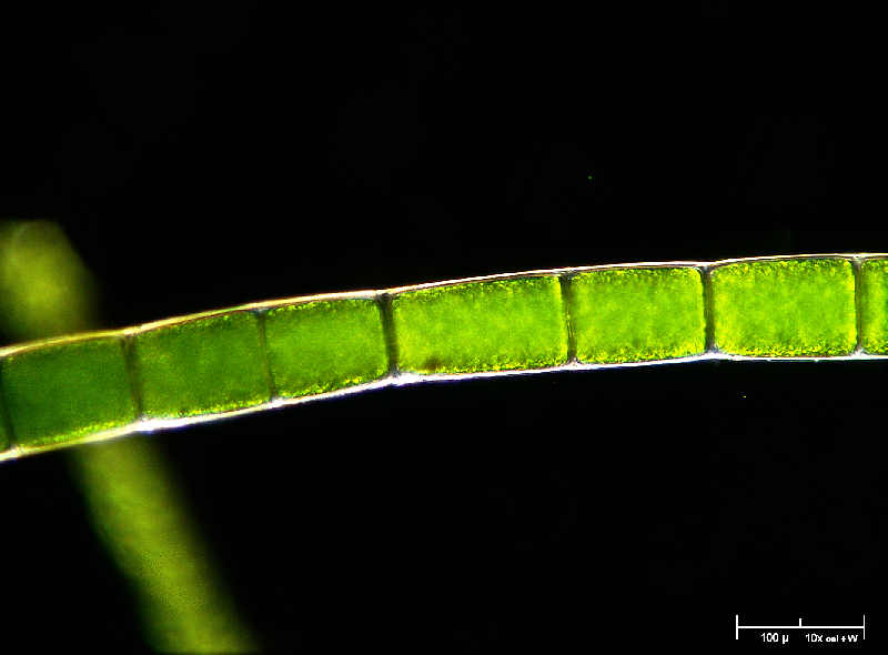 Microspora in campo oscuro