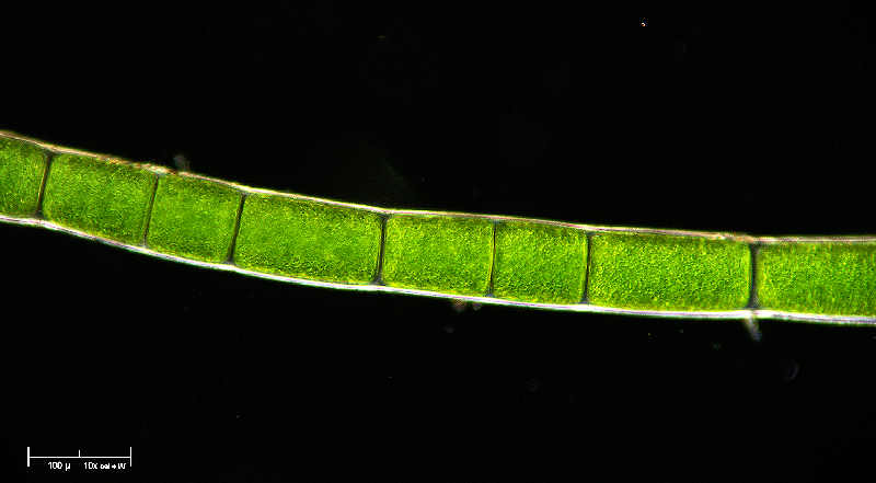 Microspora in campo oscuro