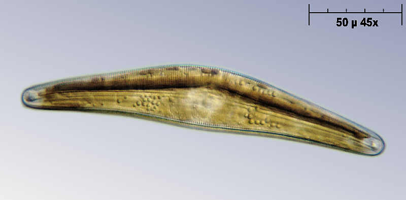 Cymbella gastroides