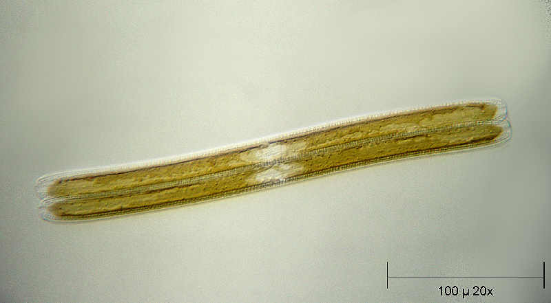 Nitzschia sigmoide