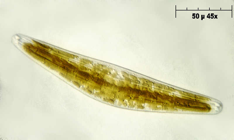Cymbella gastroides 2