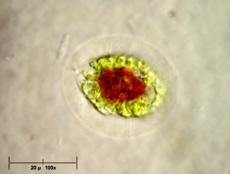 Haematococcus pluvialis ........finalmente !
