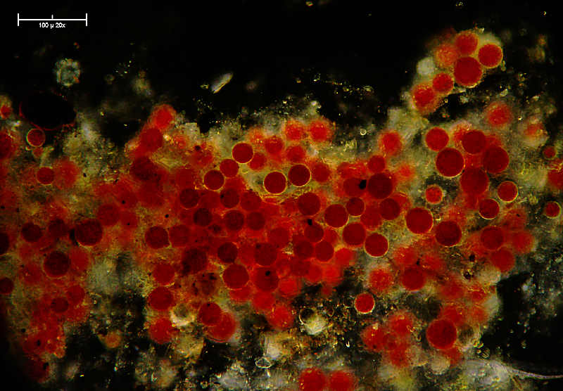 Haematococcus pluvialis  campo oscuro 10x
