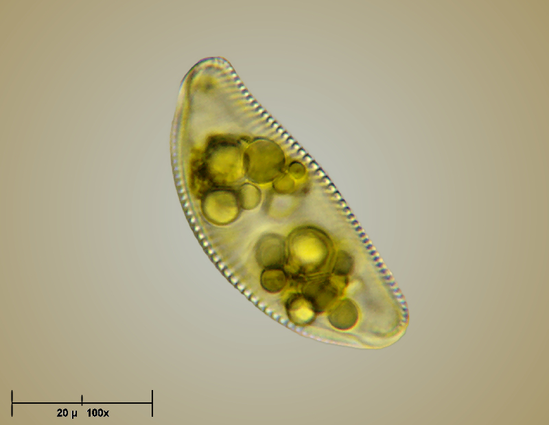 Encyonema caespitosum - 100x oil immersion