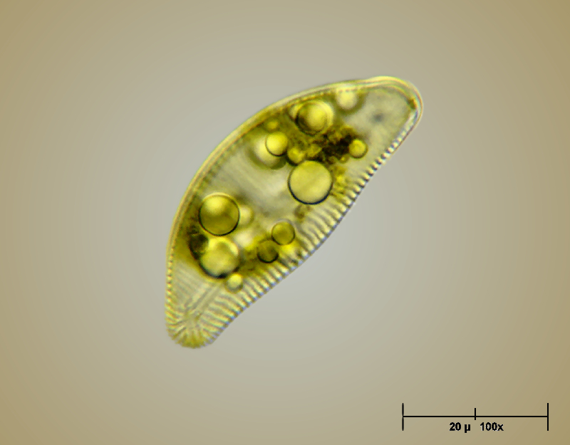 Encyonema caespitosum - 100x oil immersion