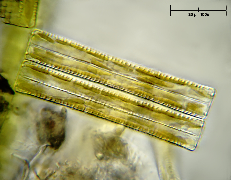 Diatoma sp.