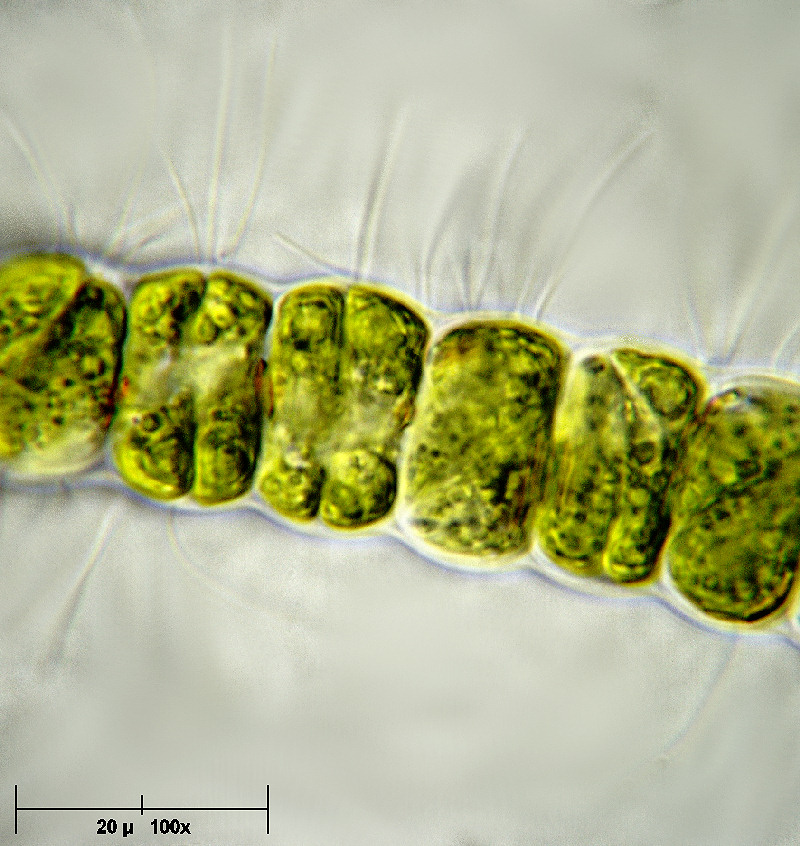 Hyalotheca dissiliensis