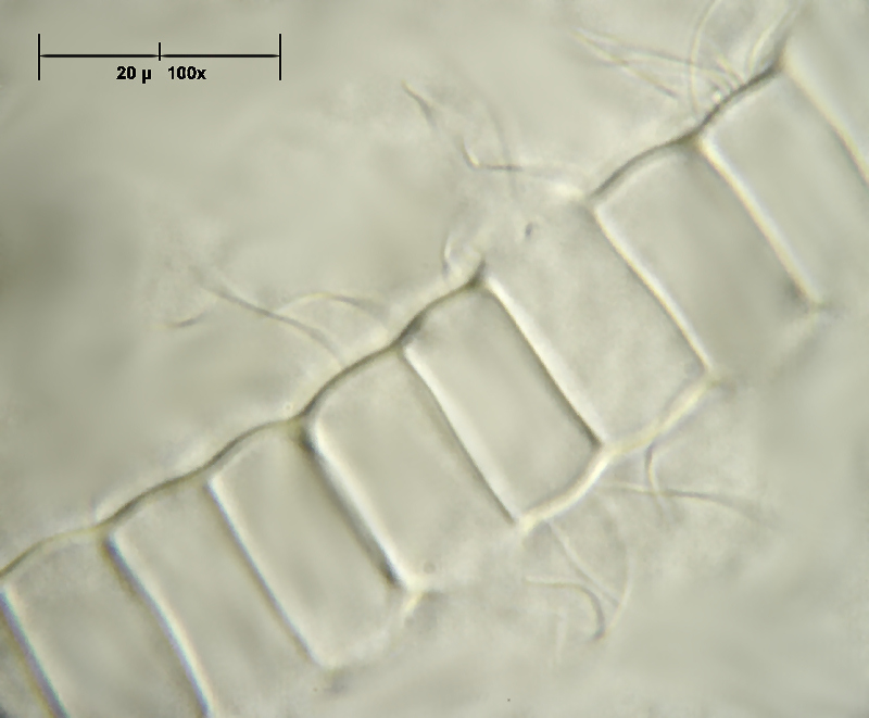 Hyalotheca dissiliensis