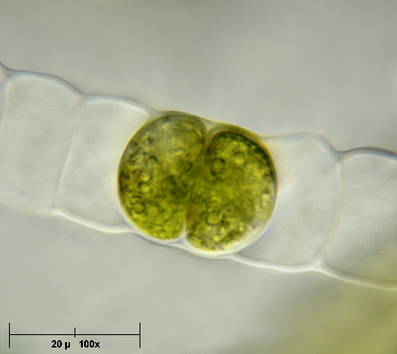 Hyalotheca dissiliensis