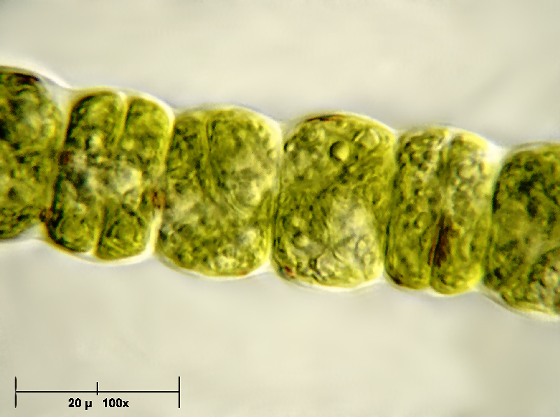 Hyalotheca dissiliensis