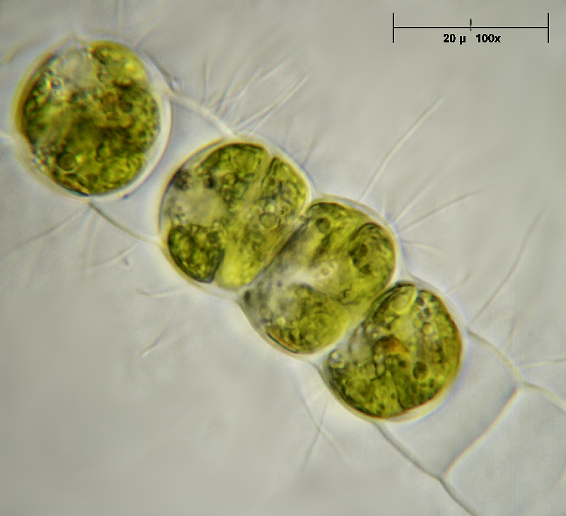 Hyalotheca dissiliensis