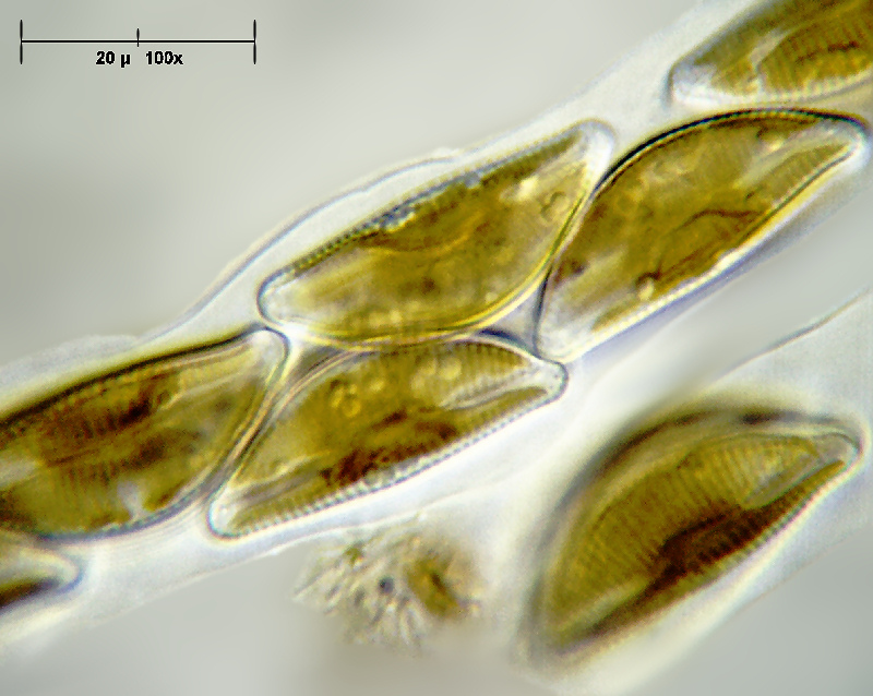 Encyonema prostratum