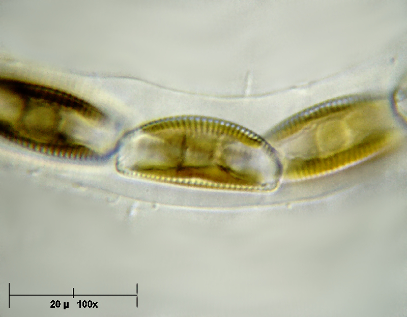 Encyonema prostratum