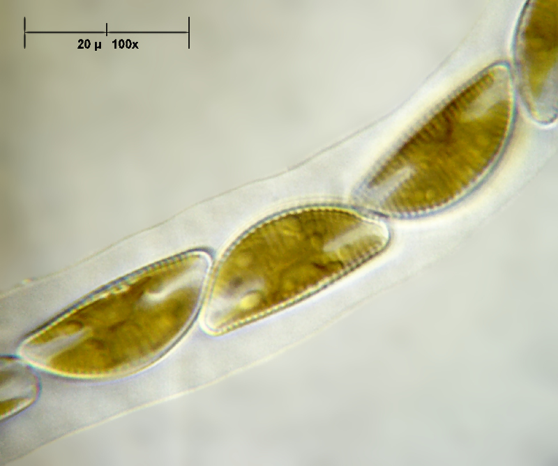 Encyonema prostratum