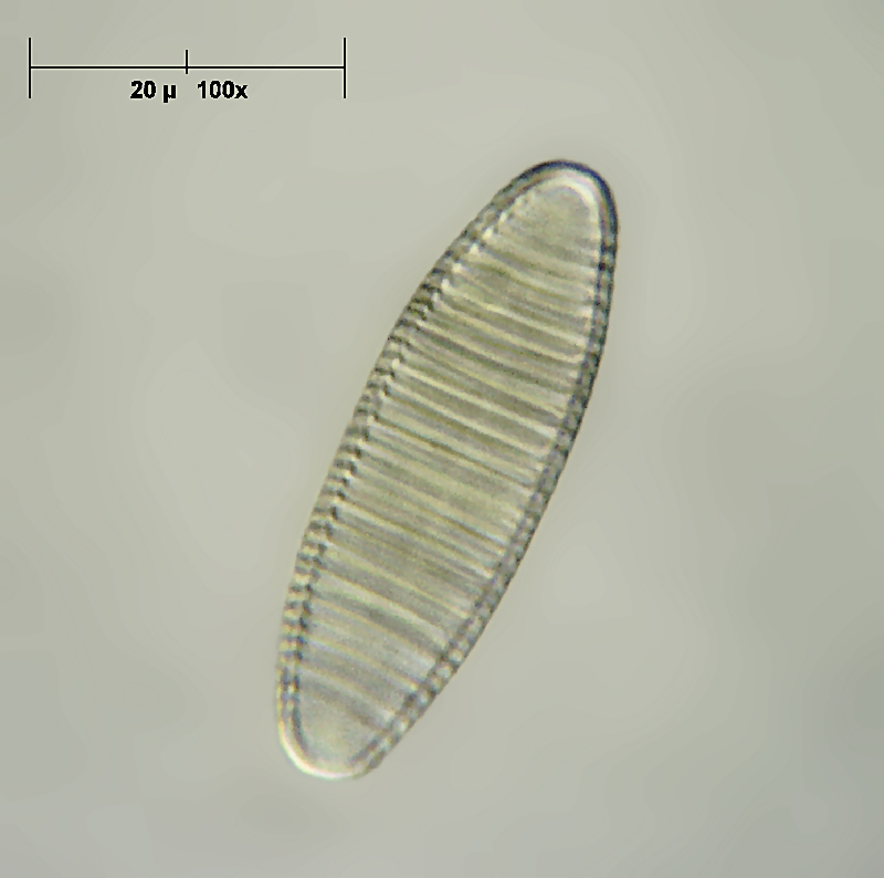 Diatoma vulgaris - vista valvare
