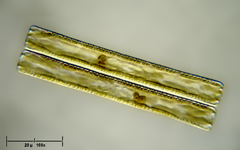 Diatoma vulgaris