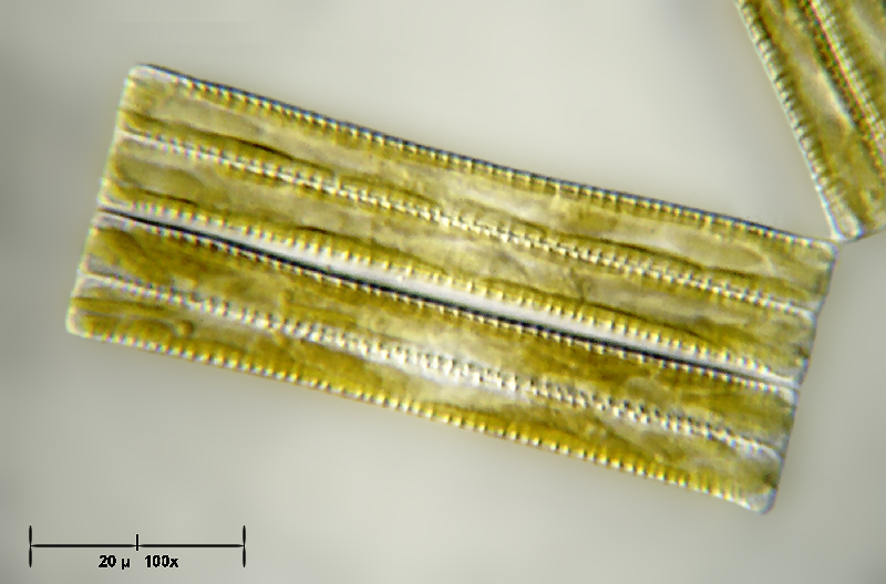 Diatoma vulgaris