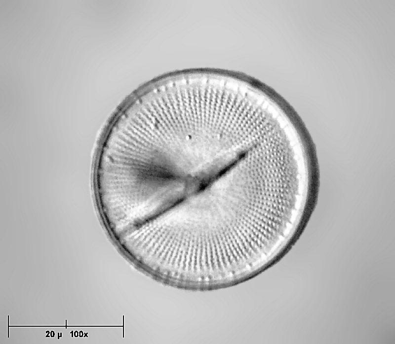 Cyclotella stelligera ? -- no Stephanodiscus sp.