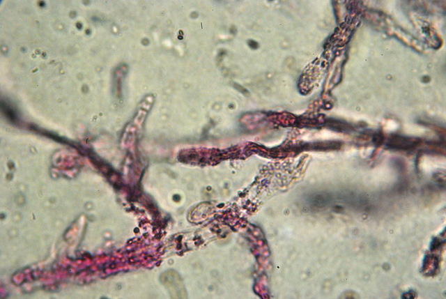 Reagenti chimici nei funghi