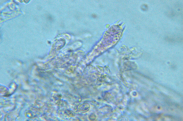 Tephrocybe anthracophila