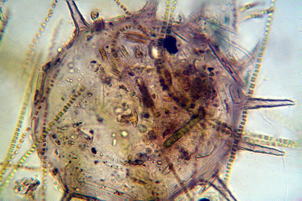 ancora Centropyxis