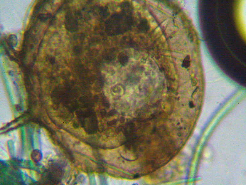 centropyxis
