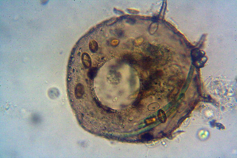 arcella e centropyxis aculeata
