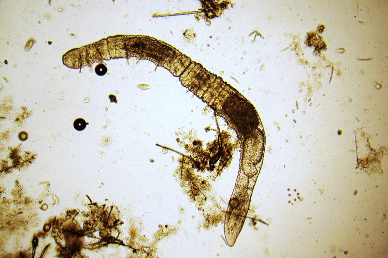 Chaetogaster sp.