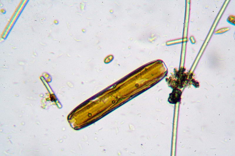 Pinnularia sp.