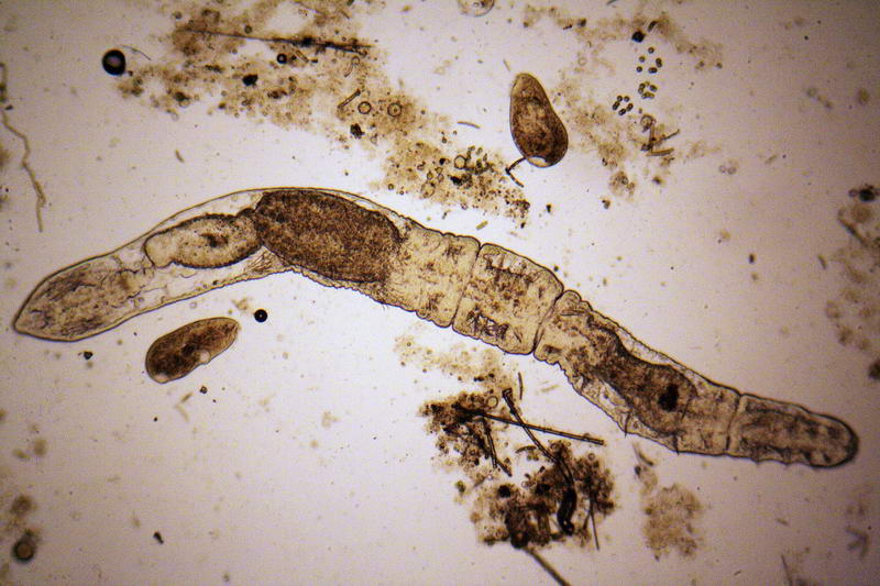 Chaetogaster sp.