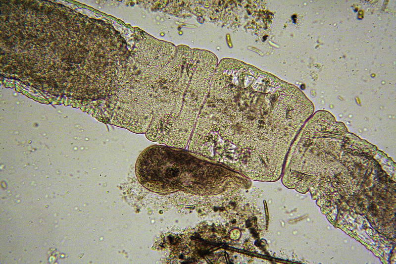 Chaetogaster sp.