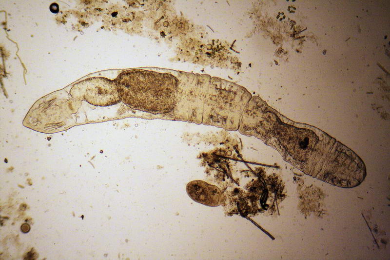 Chaetogaster sp.