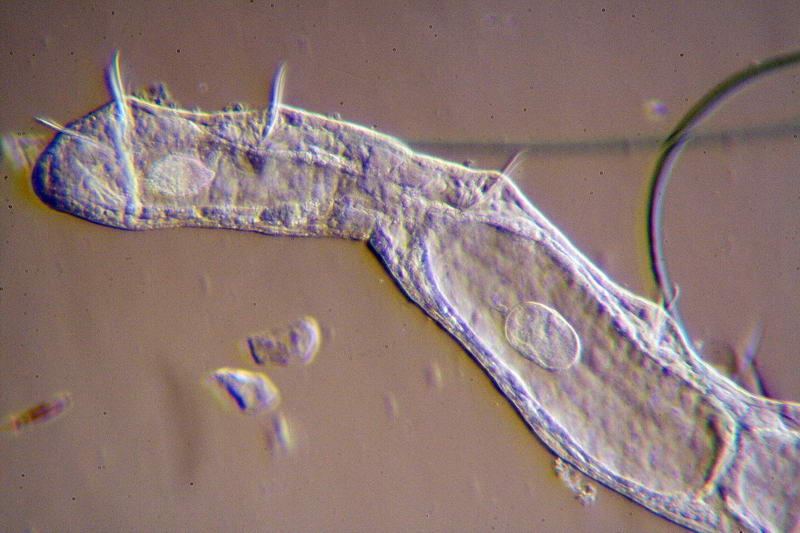 Chaetogaster in obliqua