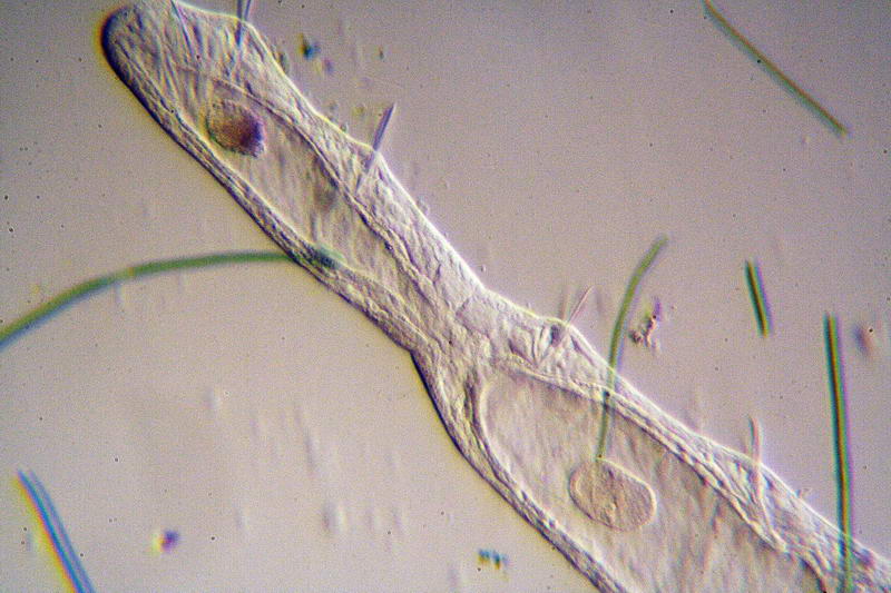 Chaetogaster in obliqua