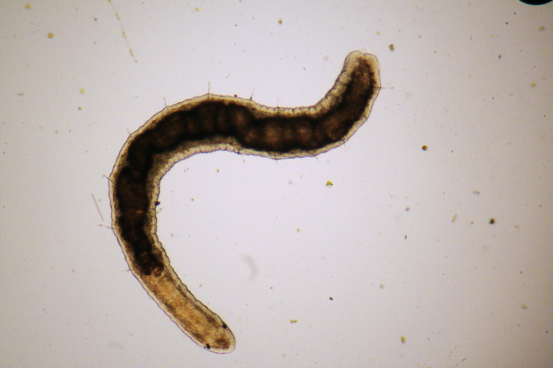 oligochete (Stylaria sp???) - immagini